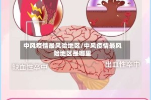 中风疫情最风险地区/中风疫情最风险地区是哪里