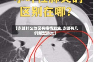【赤峰什么地区有疫情发生,赤峰有几例新型肺炎】