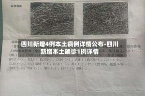 四川新增4例本土病例详情公布-四川新增本土确诊1例详情