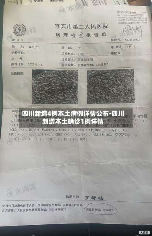 四川新增4例本土病例详情公布-四川新增本土确诊1例详情-第1张图片
